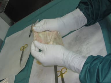 Soft Tissue allograft illustration